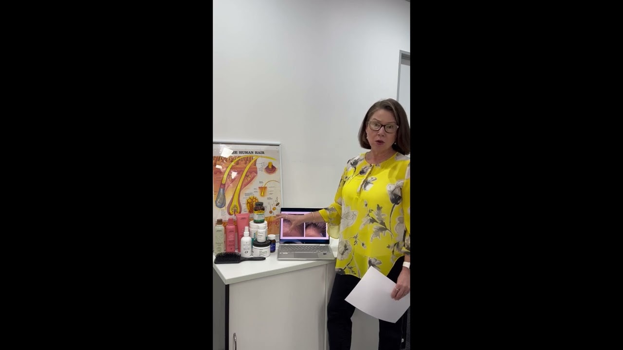 Hair Loss Treatment for Women   Results