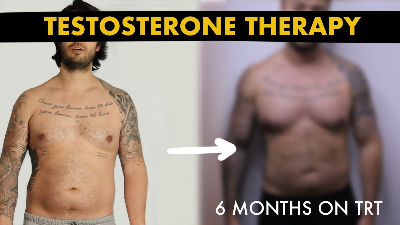 6 MONTHS ON TRT TRANSFORMATION | Testosterone Replacement Therapy