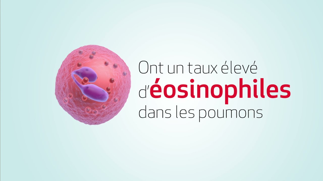 M&eacute;canisme d'action de cellule &eacute;osinophile dans l'asthme s&eacute;v&egrave;re &agrave; &eacute;osinophiles