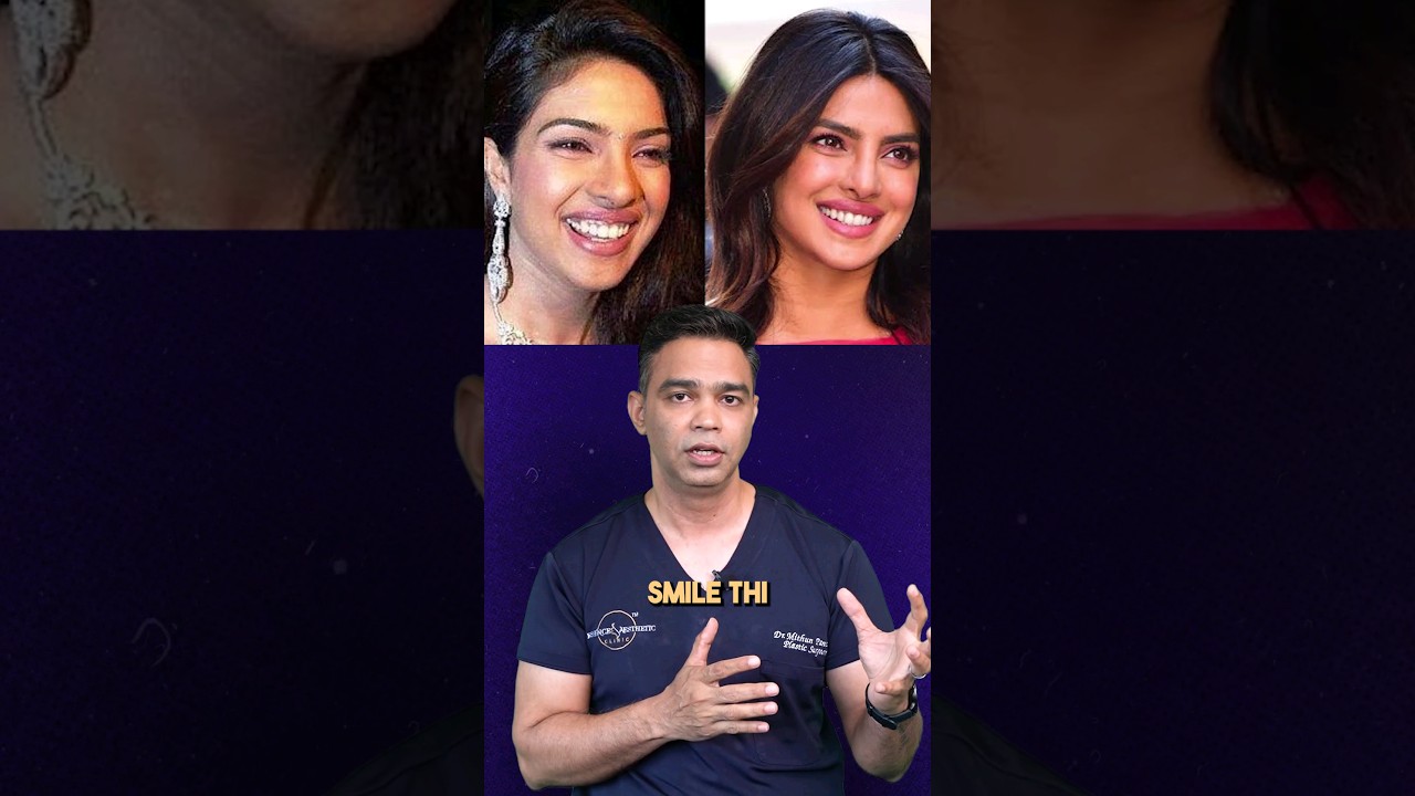 Priyanka Chopra's Plastic Surgery transformation. 💉