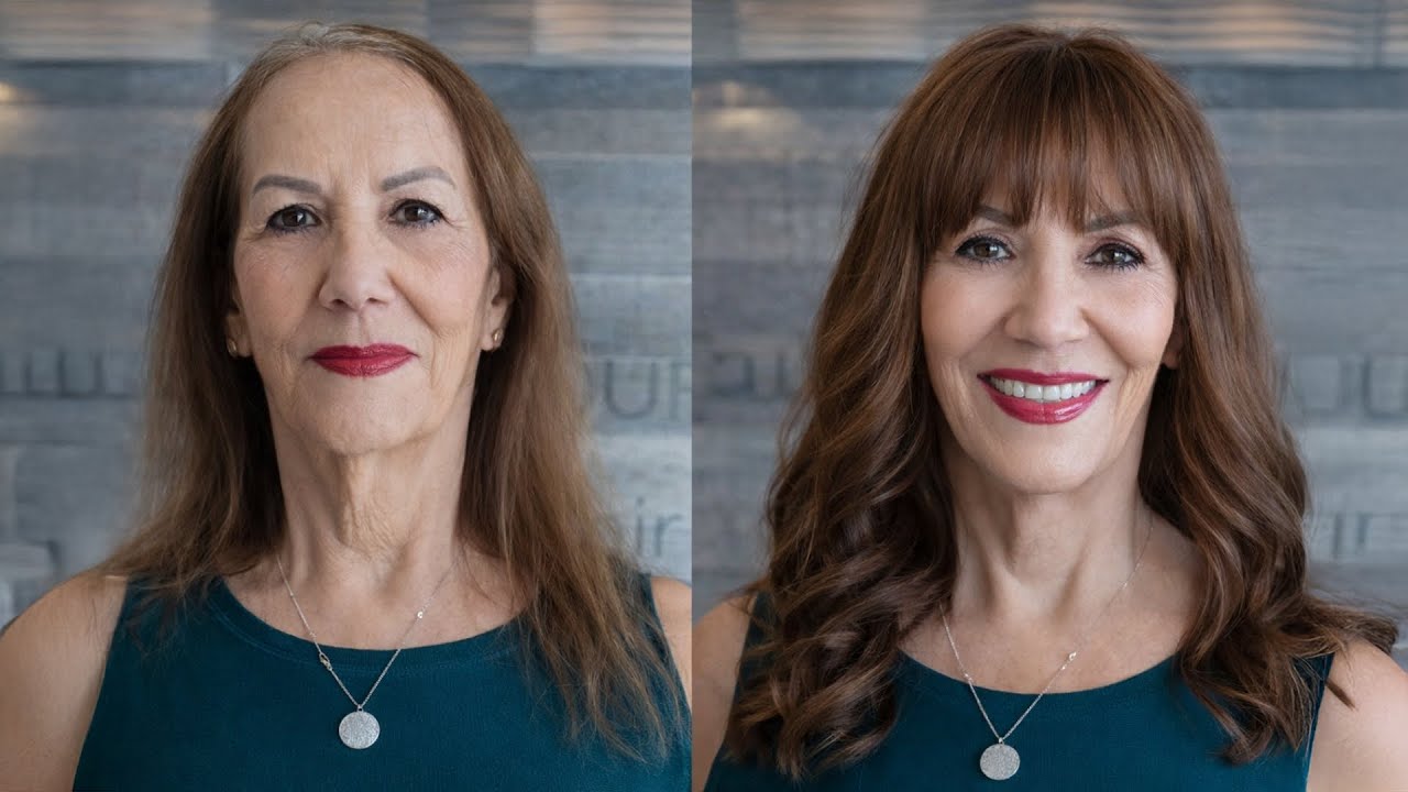 Crown Fusion Hair Extensions: For Women With Balding and Thinning On Top Of Their Head