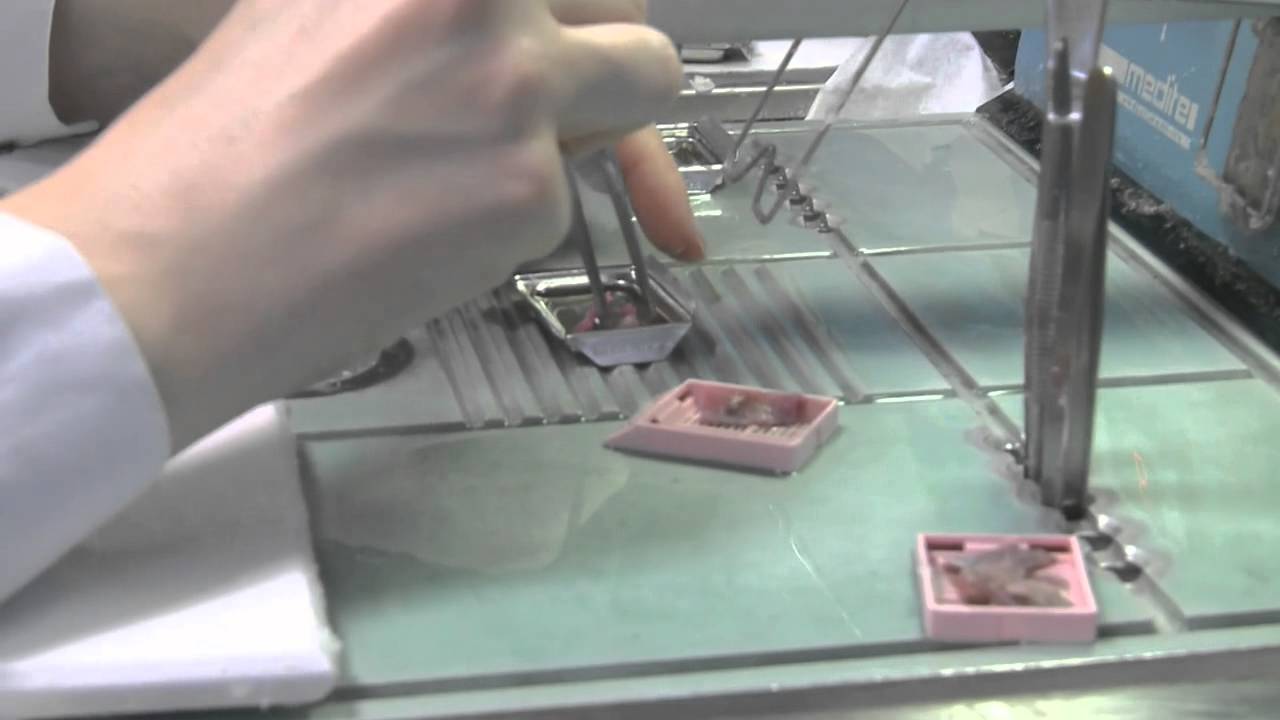 Plongée dans le service anatomo-cyto-pathologie avec le Dr Eric Frouin