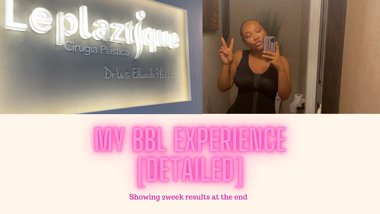 My BBL Experience | DETAILED | BBL Journey | Dr. Plazas | Cali, Colombia | I Got a BBL