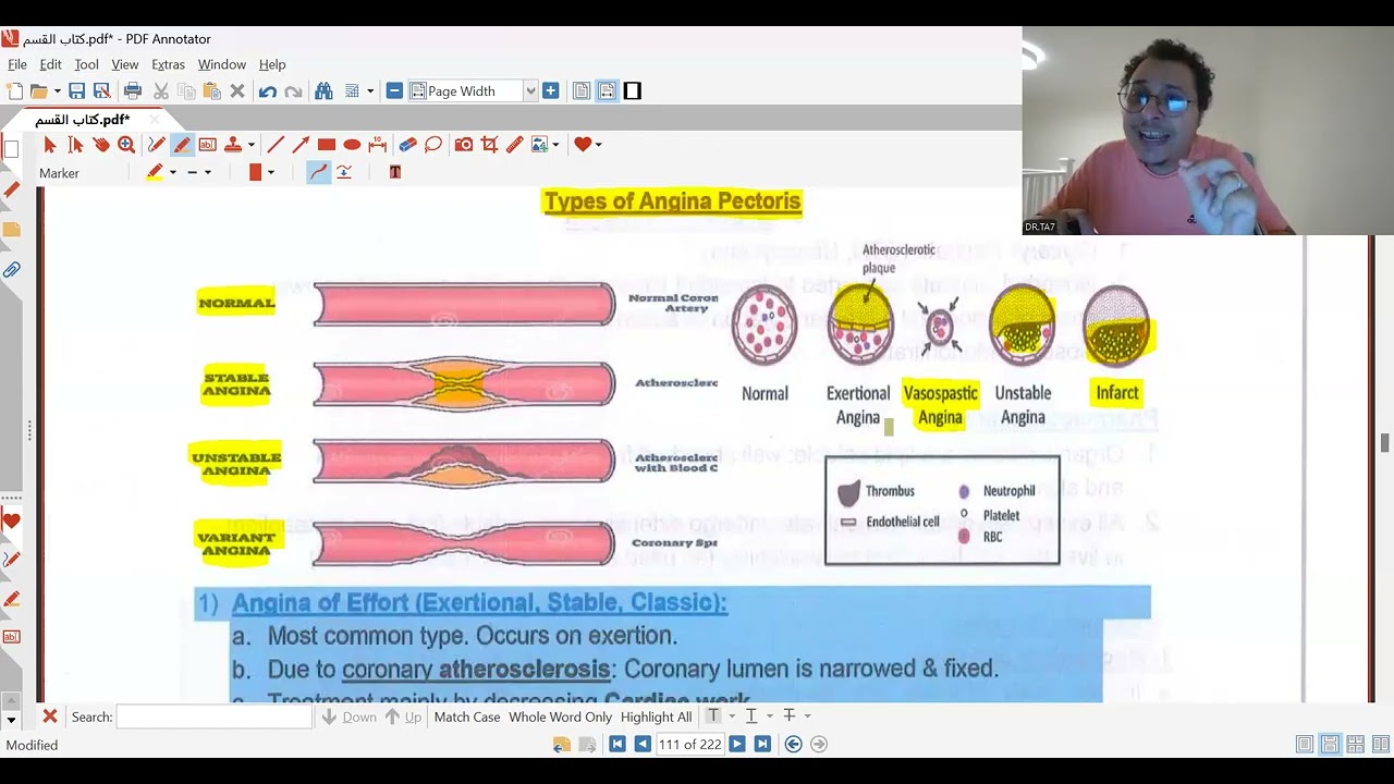 DR TA7: CVS PHARMACOLOGY 1 (MED SCHOOL NOT USMLE)