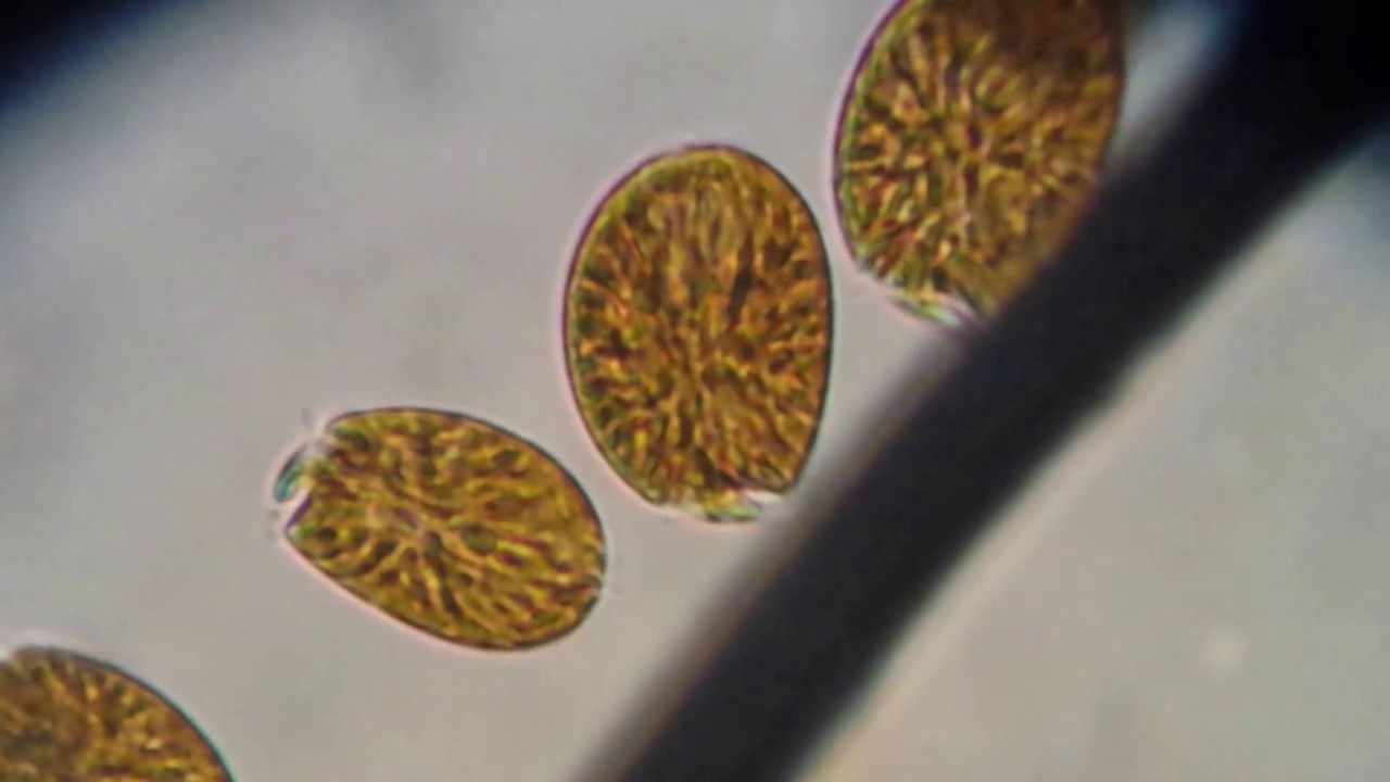 Amphidinium with flagella visible