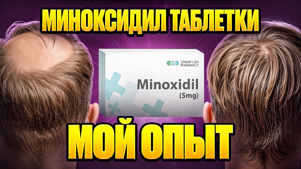 Побочные эффекты миноксидила — правда или миф?