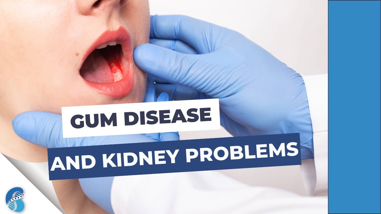 Can gum disease cause kidney problems?