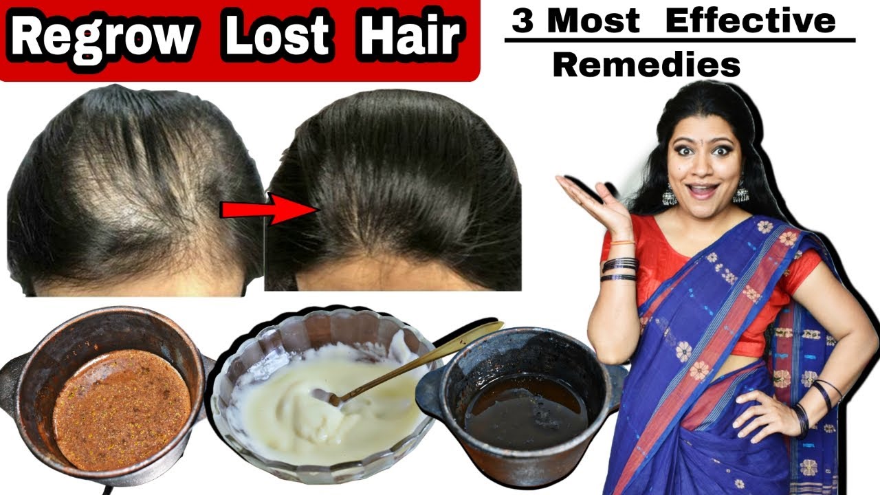 100% Regrow Lost Hair Naturally : 3 Most Powerful Ways To Grow Lost Hair Back & Make Hair Thicker