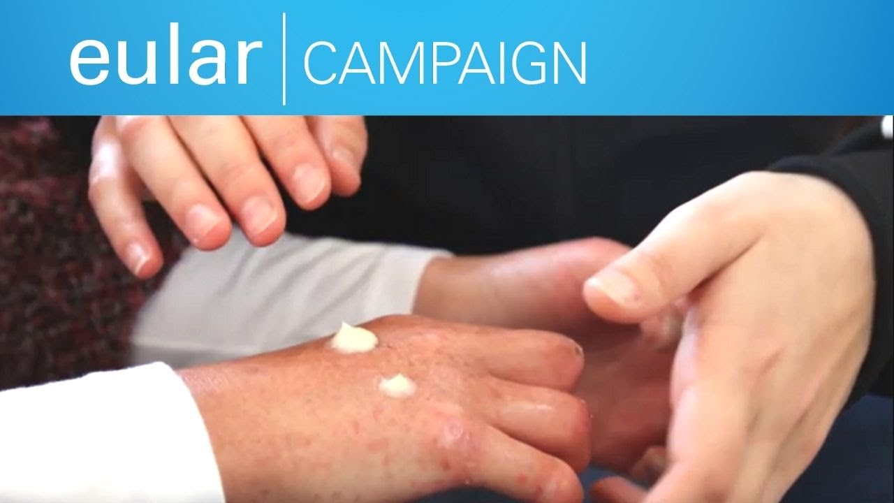 World Arthritis Day 2019: EULAR Campaign Time2Work, A Day in the Life in Cyprus