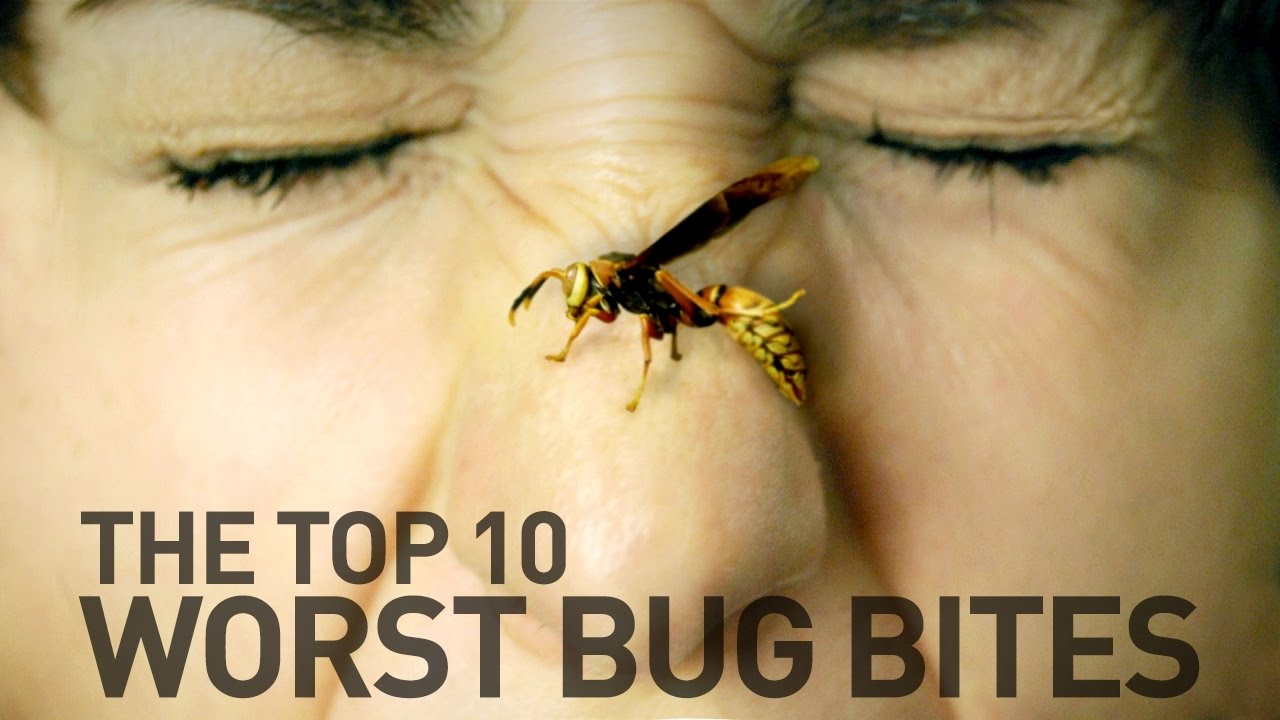 Top 10 Most Painful Bug Bites and Stings