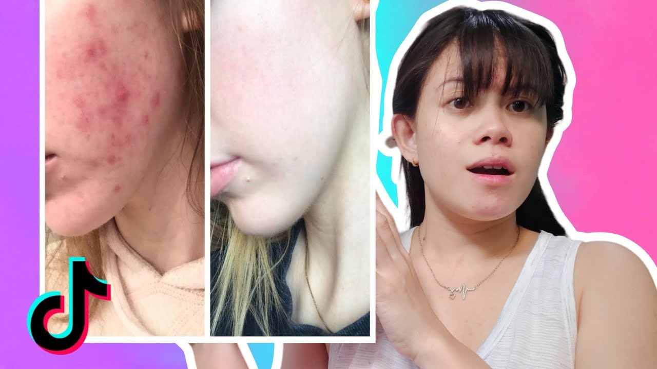 SECRET TO HAVE A CLEAR SKIN| SKIN CARE HACKS|TRENDING ON TIKTOK
