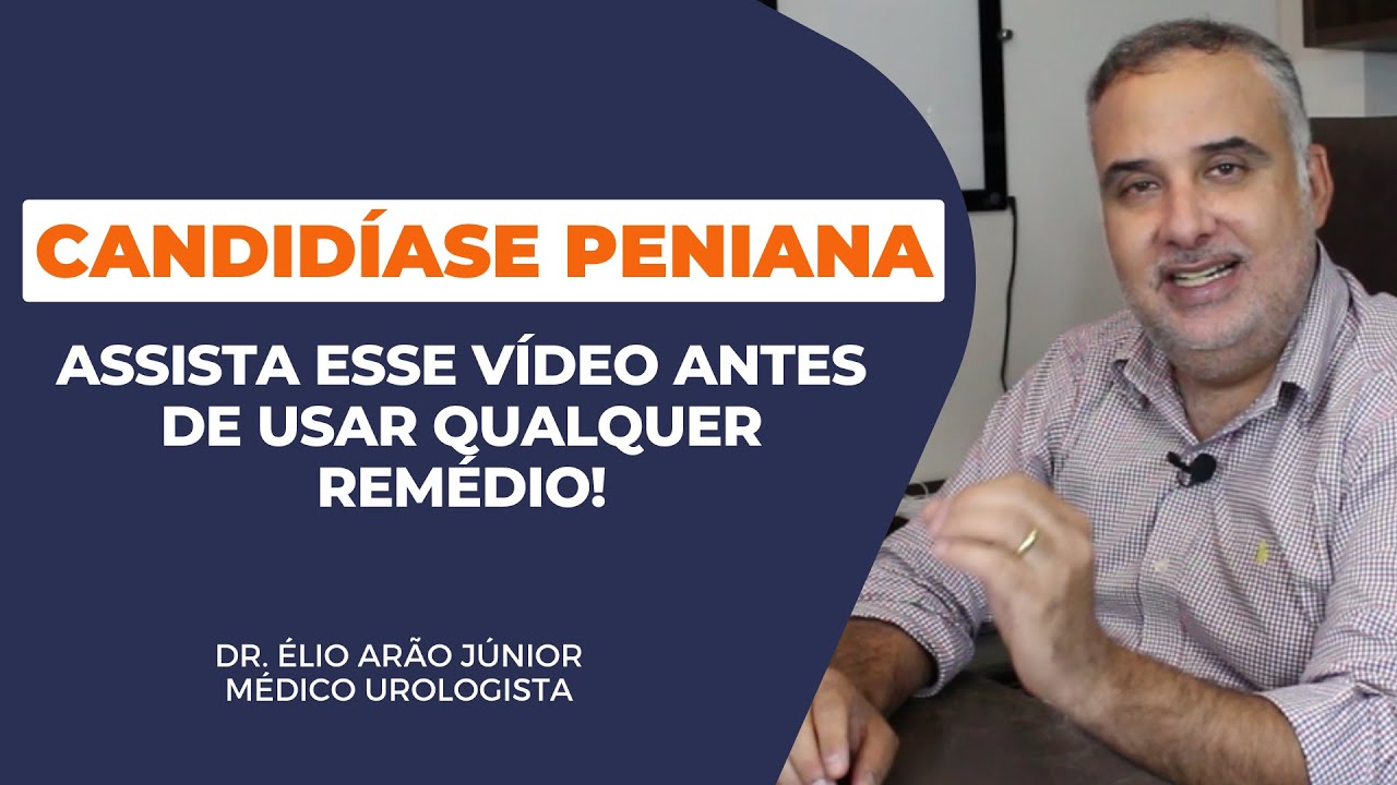 TUDO SOBRE Candidíase peniana | Sintomas | Causas | Riscos | Tratamentos | Dr. Élio Arão Júnior