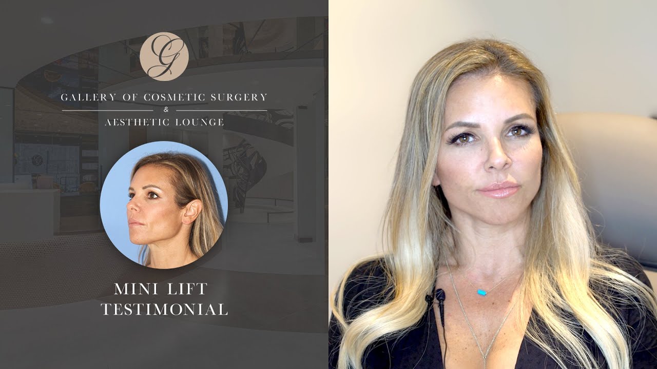 Mini Facelift Testimonial