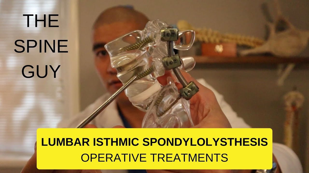 Lumbar Isthmic Spondylolisthesis - Part 3 - Surgical Treatments