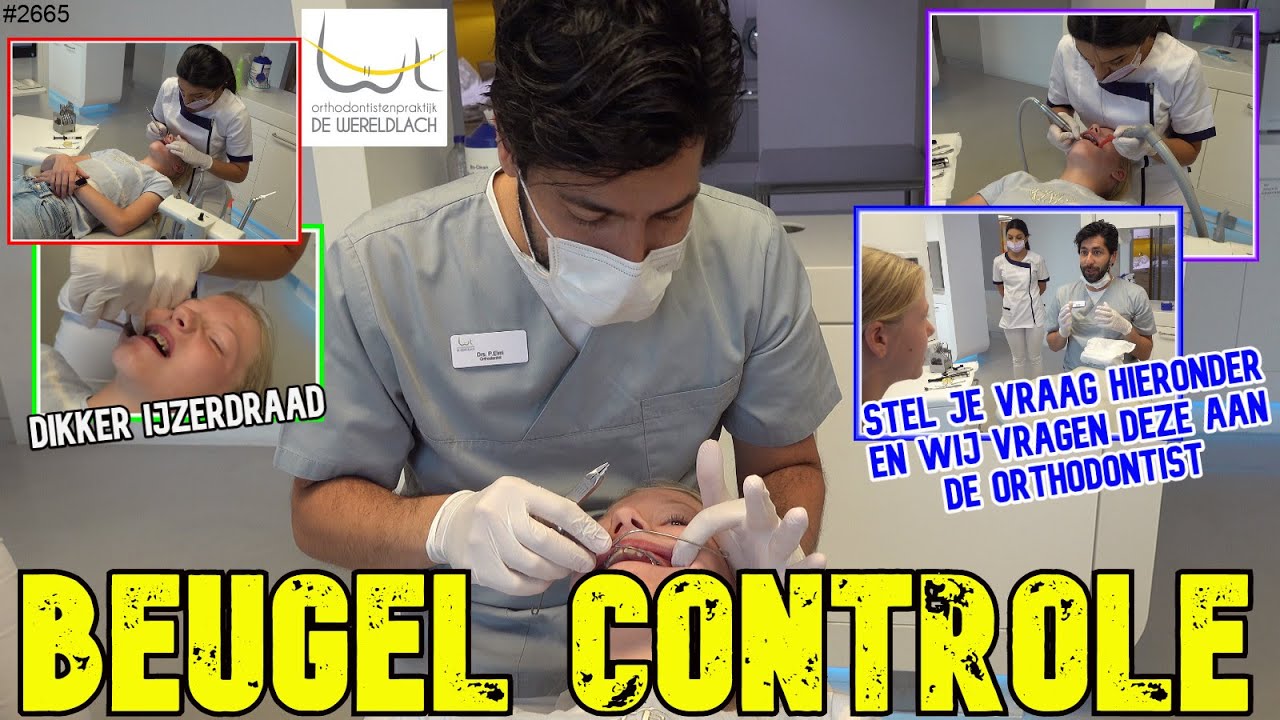 Naar de ORTHODONTIST voor DIKKER IJZERDRAAD in mijn BEUGEL. Heb je een vraag,laat het mij weten#2665