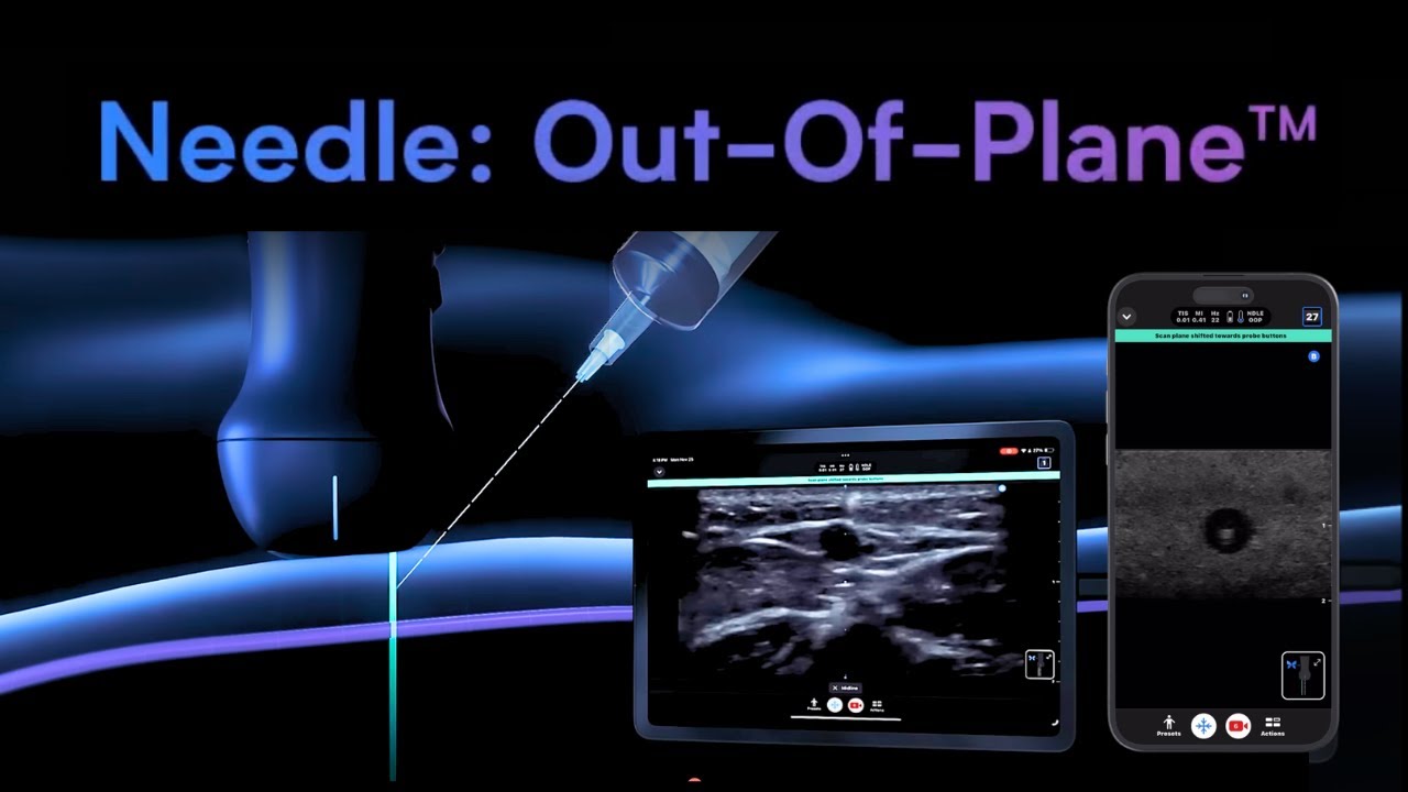 iQ3: Needle: Out-of-Plane | Butterfly Network