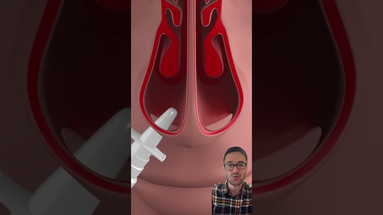 Burun spreyleri nasıl doğru kullanılır ￼