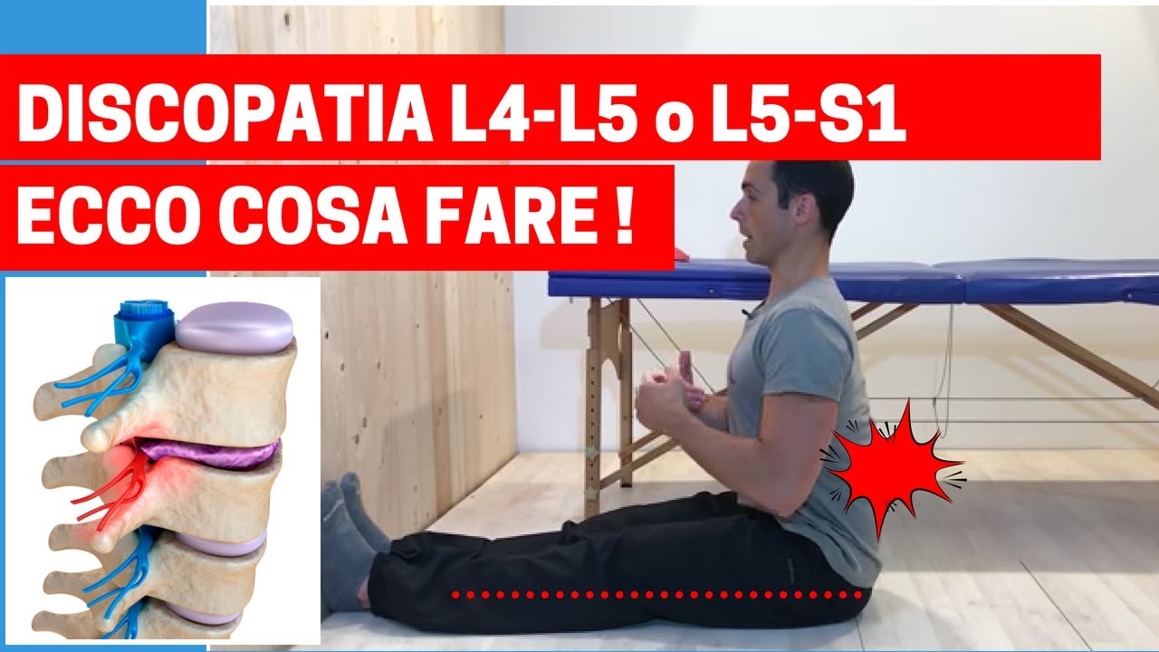 Discopatia L4-L5 o L5-S1: cosa fare + un semplice esercizio