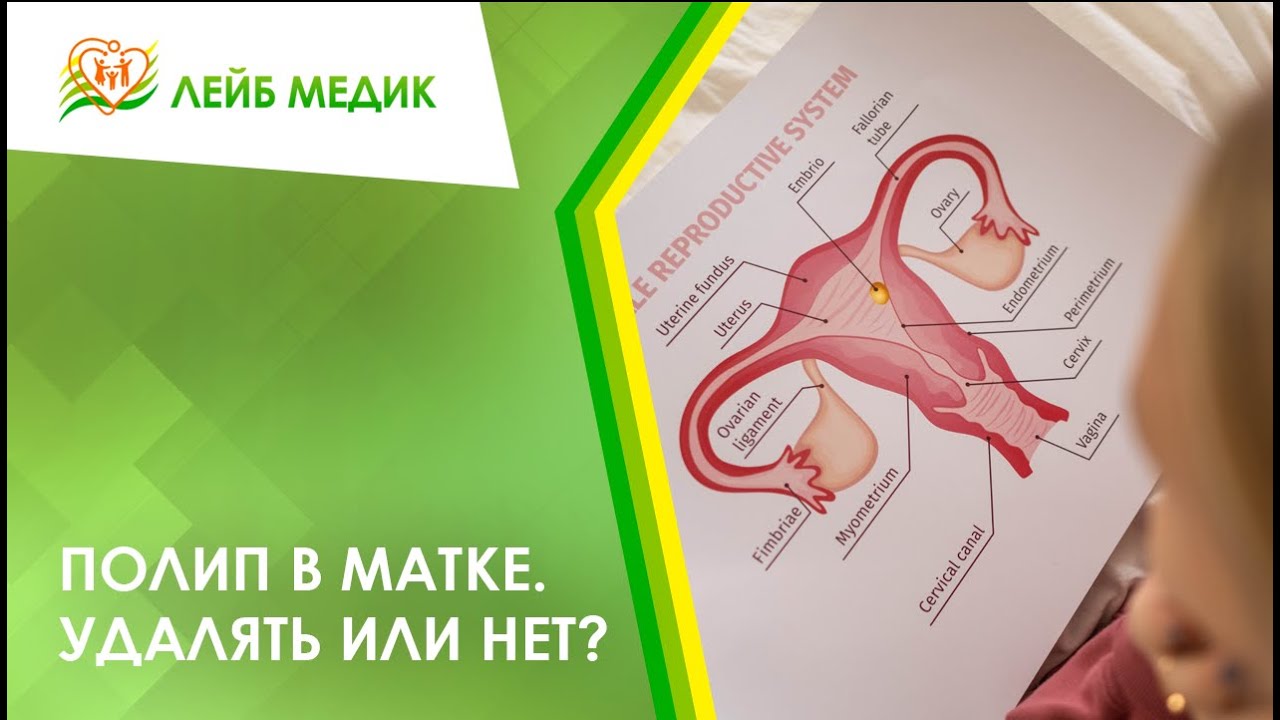 😟 Полип в матке. Удалять или нет?