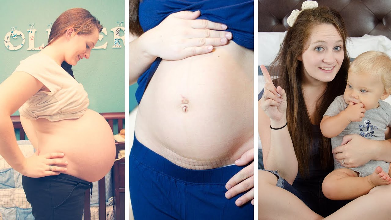 1 YEAR POSTPARTUM UPDATE!!