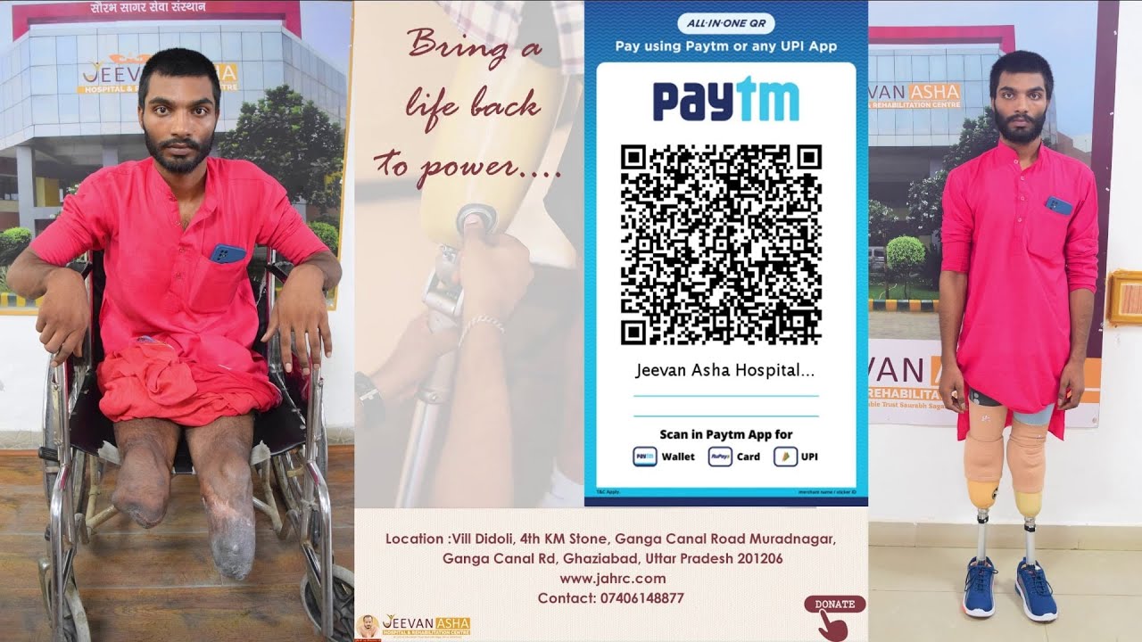 Jayprakash lost both leg in a accident Jeevan Asha Hospital provided free of cost modular prosthesis