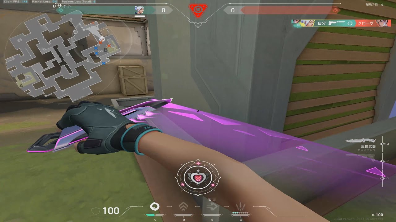 What a Crosshair (Valorant Highlights)