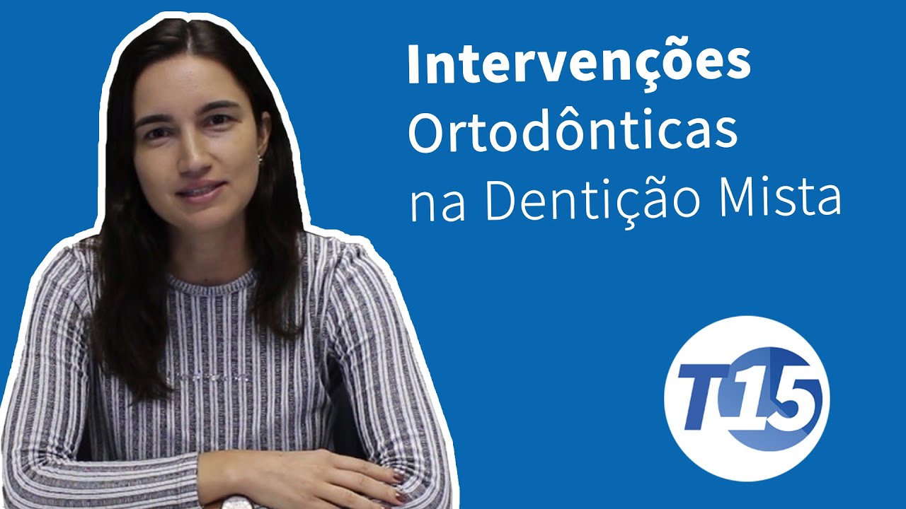 T15 Rhita  Almeida - intervenções ortodônticas na dentição mista