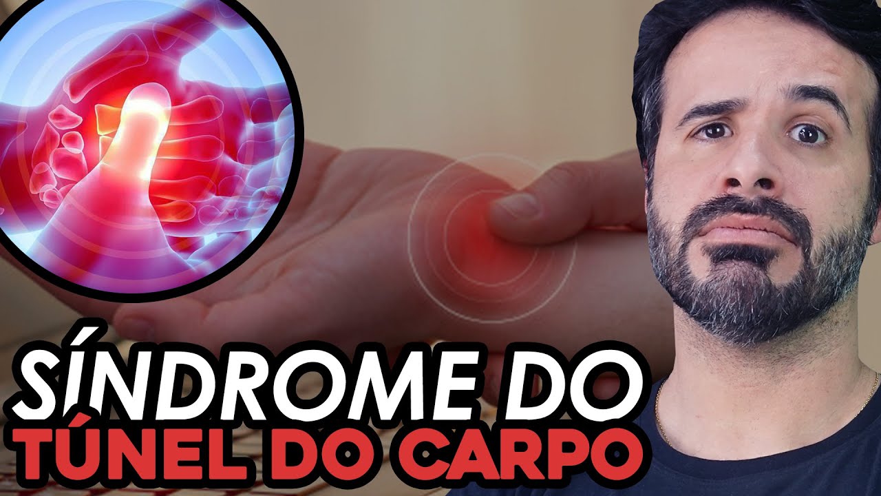 SÍNDROME DO TÚNEL DO CARPO DESSE JEITO VOCÊ VAI ENTENDER