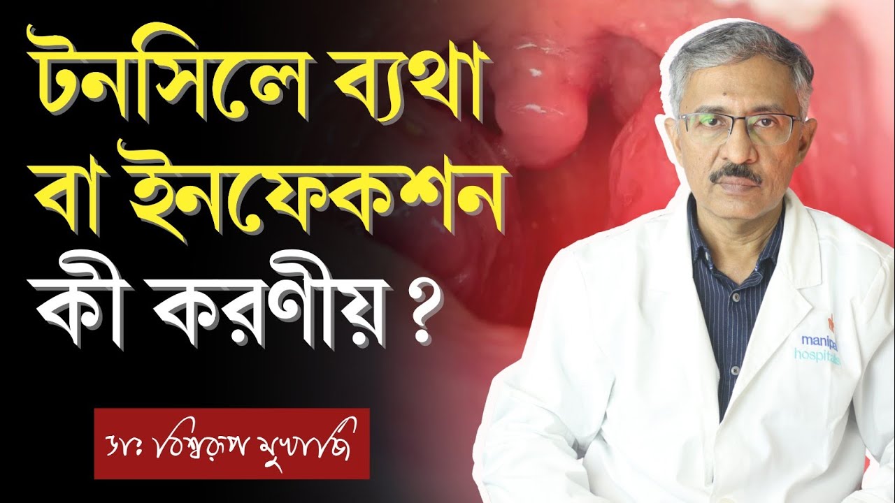 টনসিলের ব্যথা দূর করার উপায় | টনসিলের ইনফেকশন হলে করণীয় | Tonsil Infection Treatment
