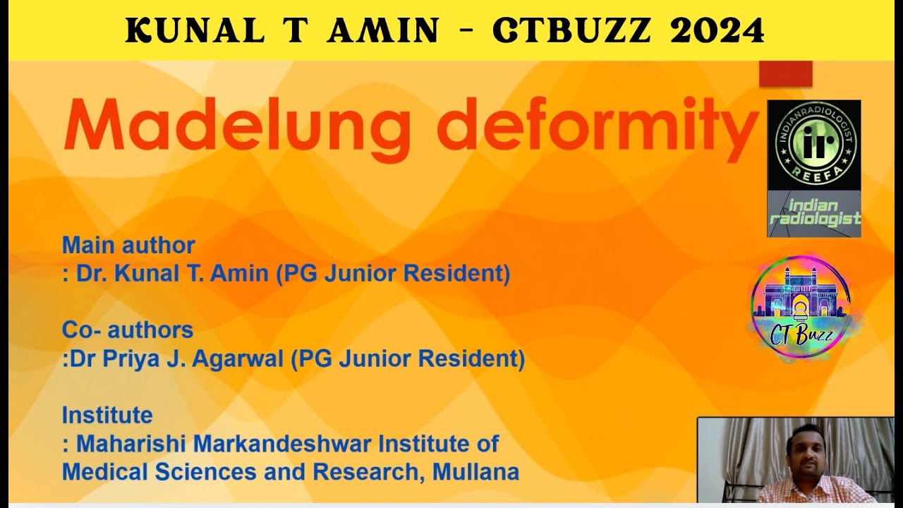 Kunal T Amin | Madelung Deformity