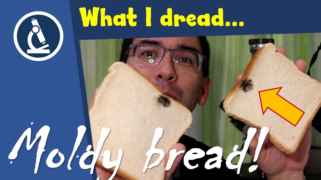 This Toast is Toast | MOLD under the microscope