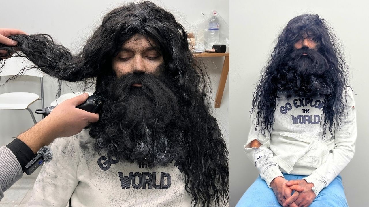 From Homeless to Handsome &ndash; Watch His Jaw-Dropping Transformation! 🤯 AMAZING!