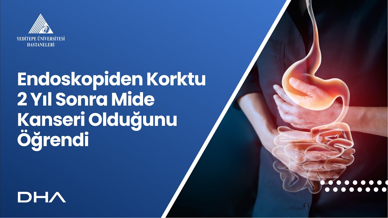 Endoskopiden Korktu 2 Yıl Sonra Mide Kanseri Olduğunu Öğrendi