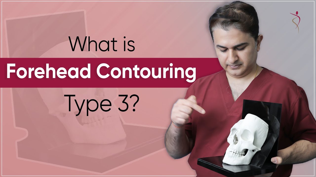 Type 3 Forehead Reconstruction | Forehead Contouring | Plastic Surgery in Mumbai