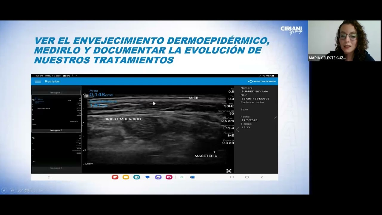 Webinar 