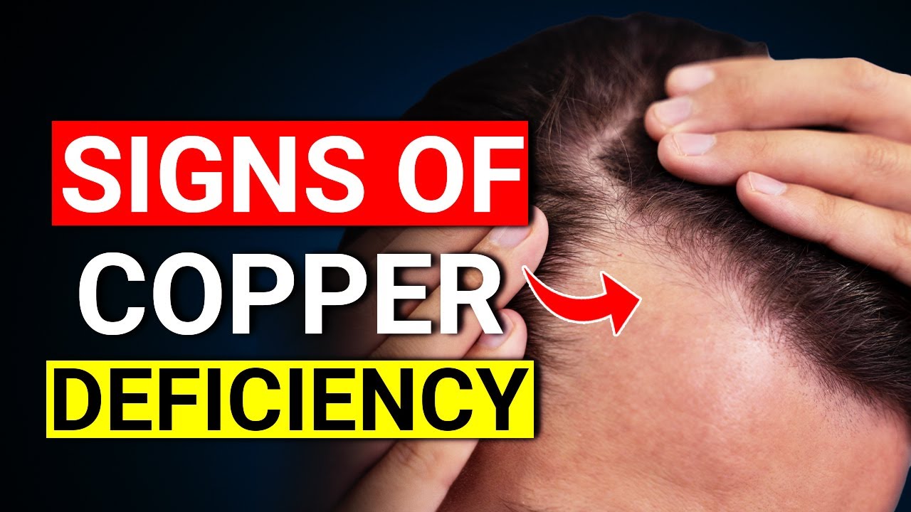 You Have To Know These Hidden Signs Of COPPER Deficiency
