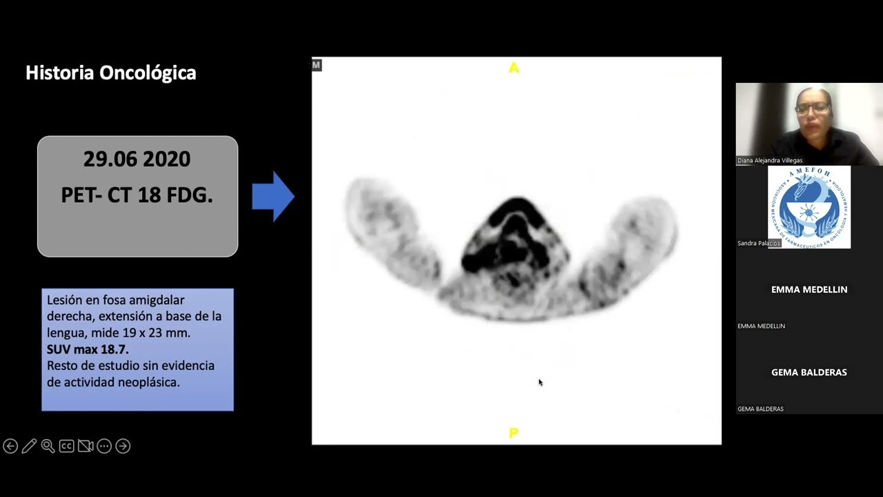 Manejo integral del paciente con c&aacute;ncer de cabeza y cuello