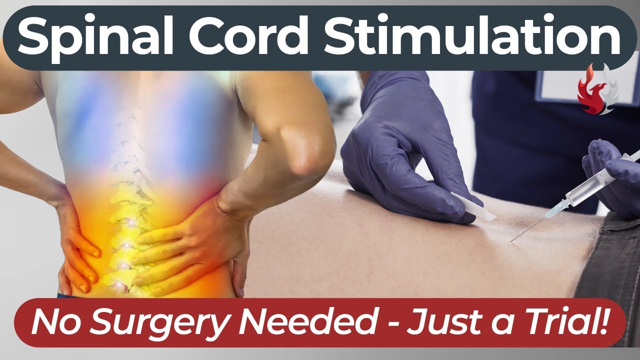 Spinal Cord Stimulation: What to Expect from Your Trial Week