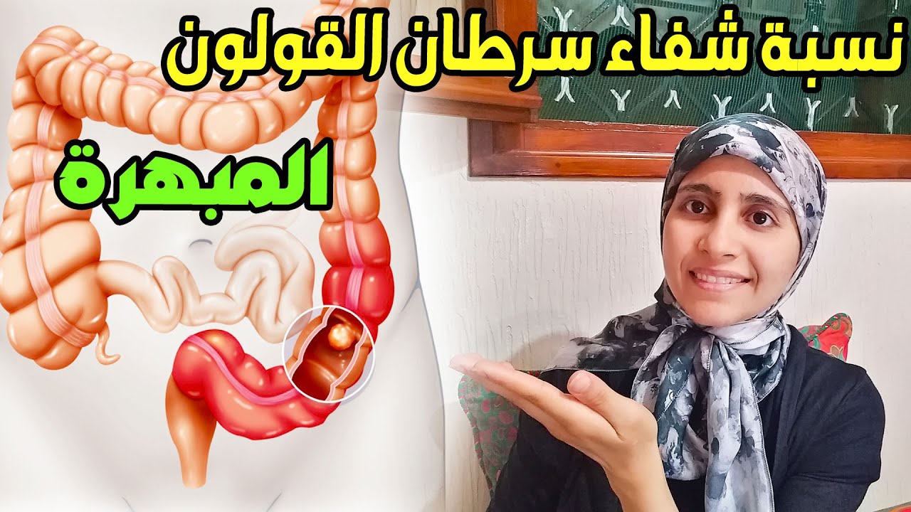 سرطان القولون ماهي أعراضه وأسبابه وكيف يمكن الوقاية منه