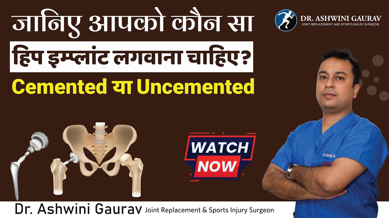 हिप रिप्लेसमेंट के लिए कौन सा इम्प्लांट सबसे अच्छा है Cemented / Uncemented? Hip Surgeries In Patna