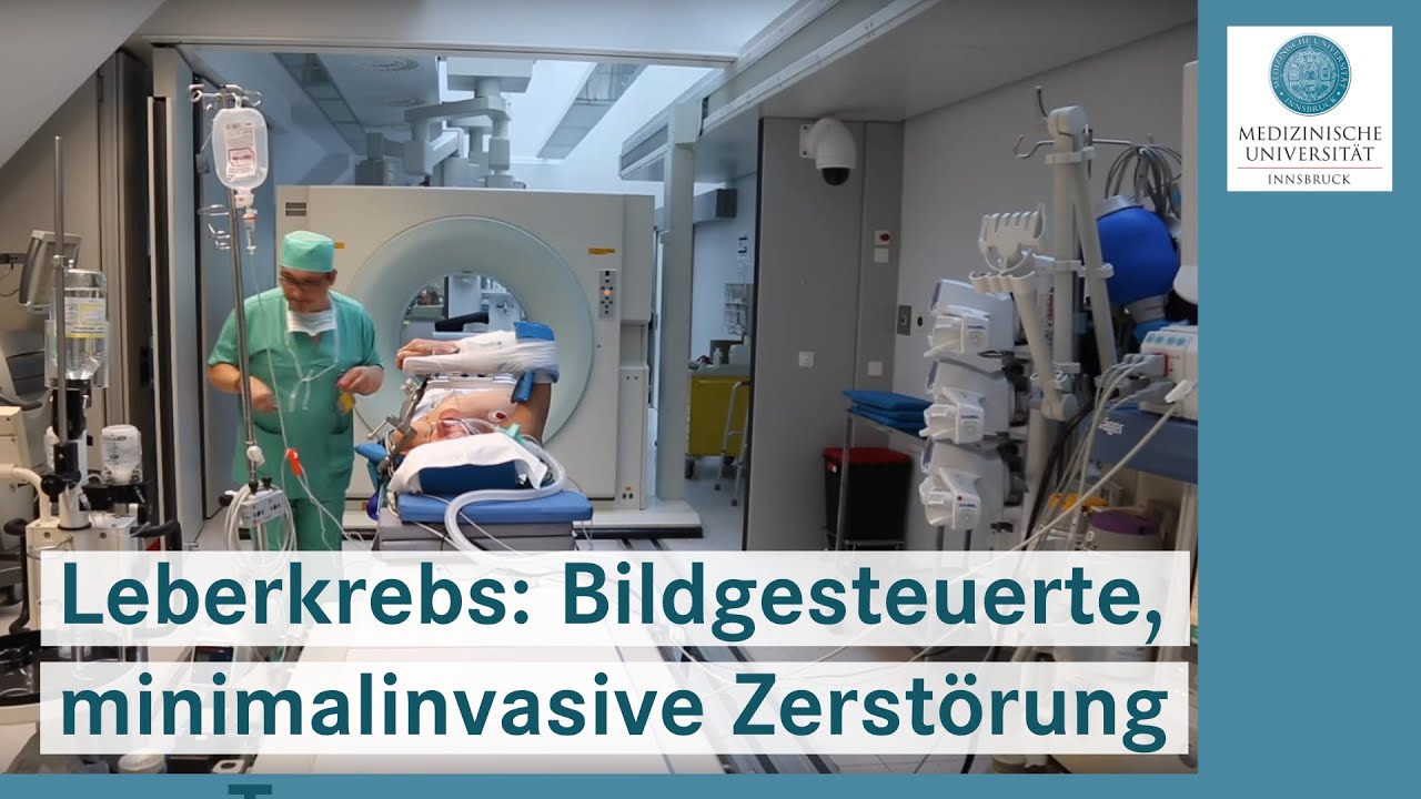 Krebs: Bildgesteuerte, minimalinvasive Zerstörung von Tumoren