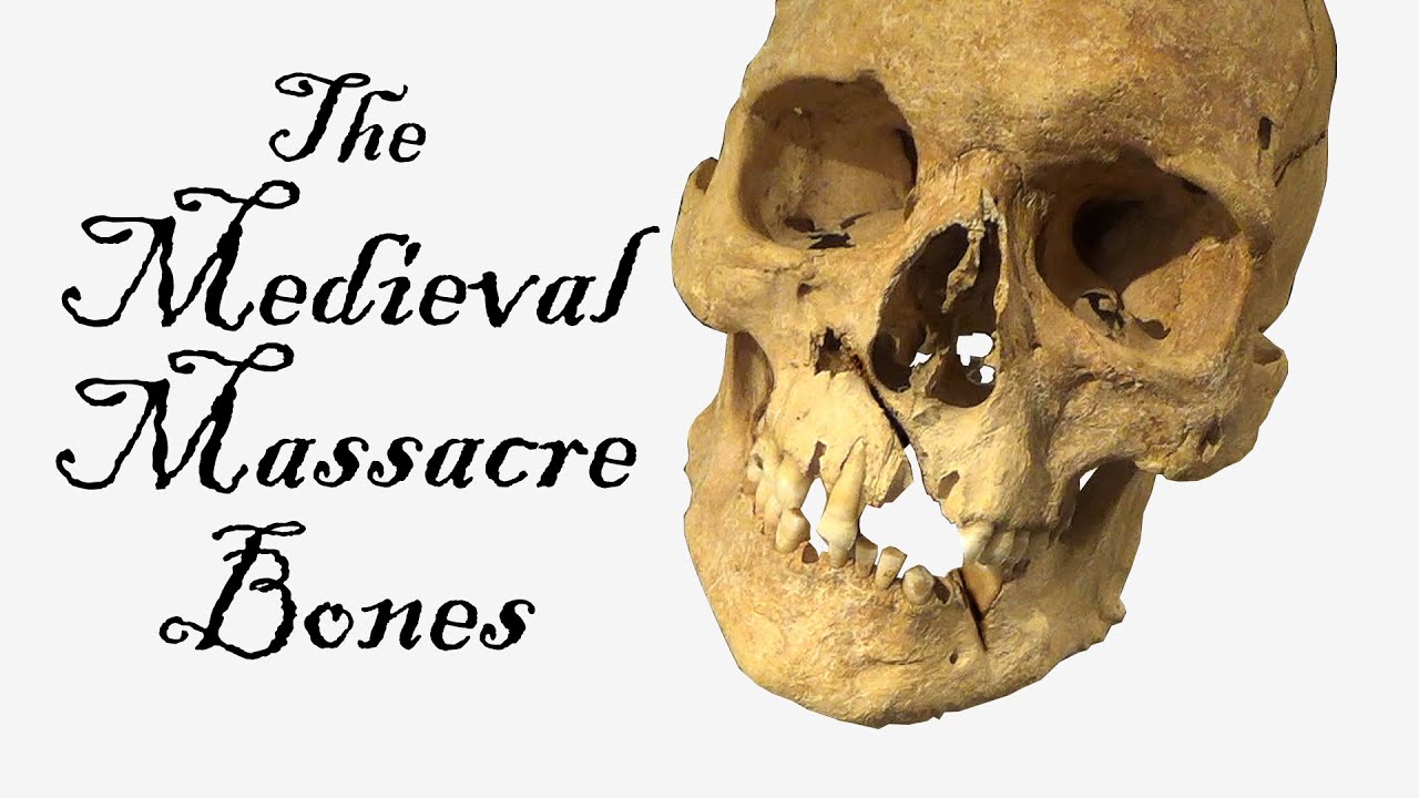 Medieval massacre bones