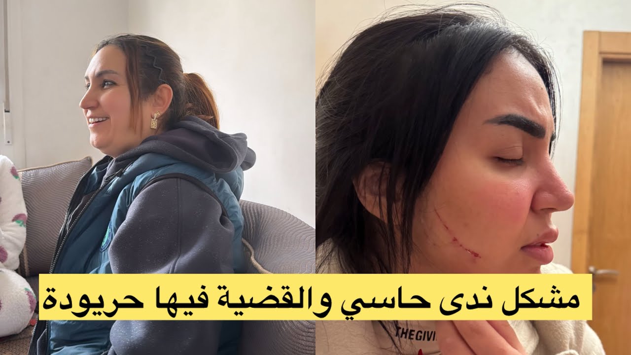 ندى حاسي .. حتى للوجه ملعبينش 
