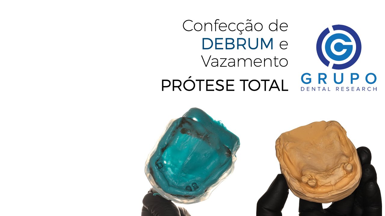 Preparo para Vazamento de Gesso Após Moldagem Funcional (Debrum) — Passo a Passo e Selado Periférico