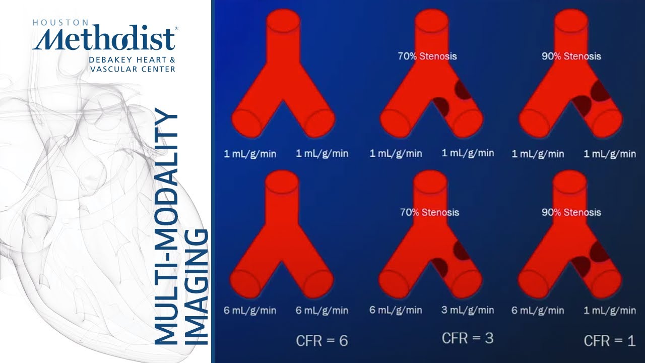 Stress CMR: Methodology,  Current Role, and Case Studies (Eric Y. Yang, MD) December 8, 2020