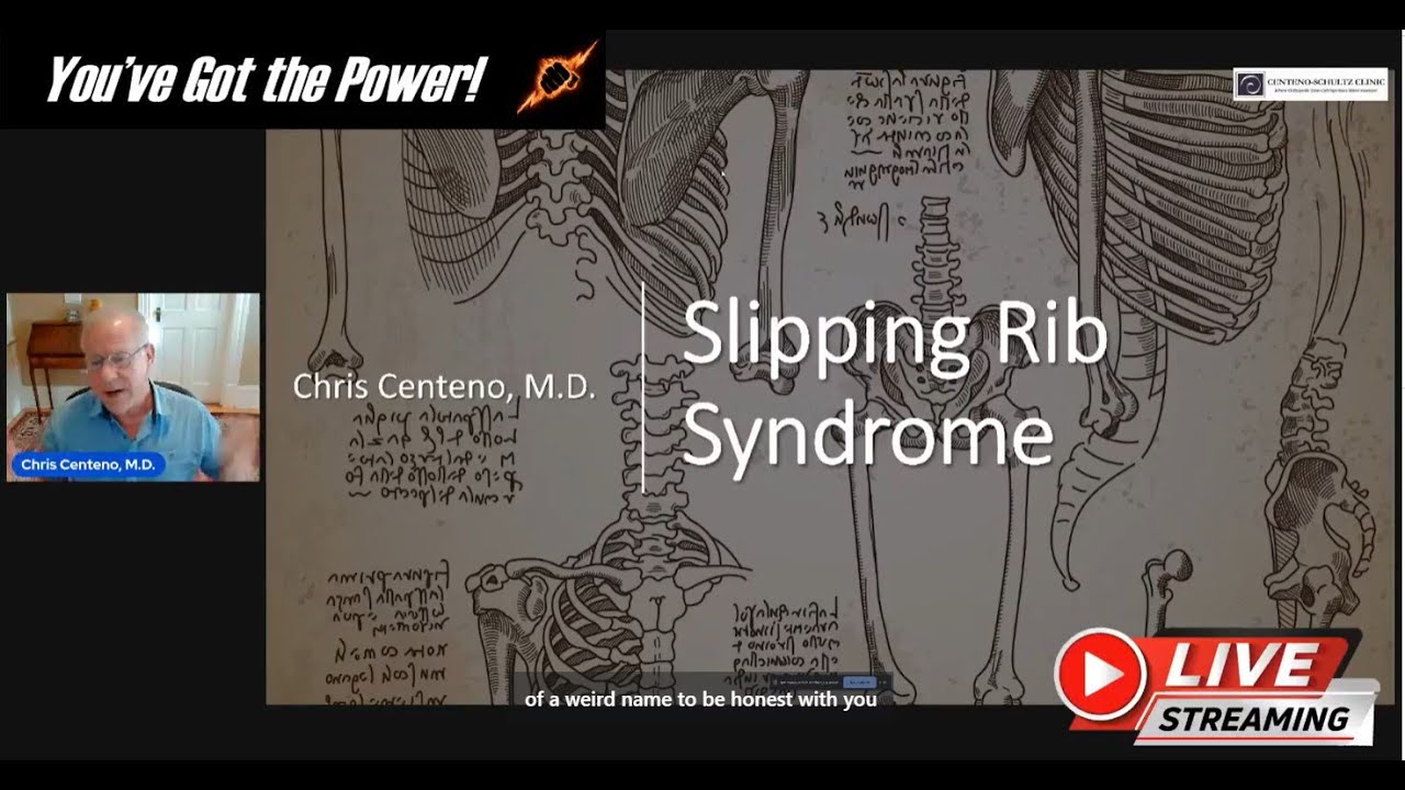 What is Slipping Rib Syndrome?