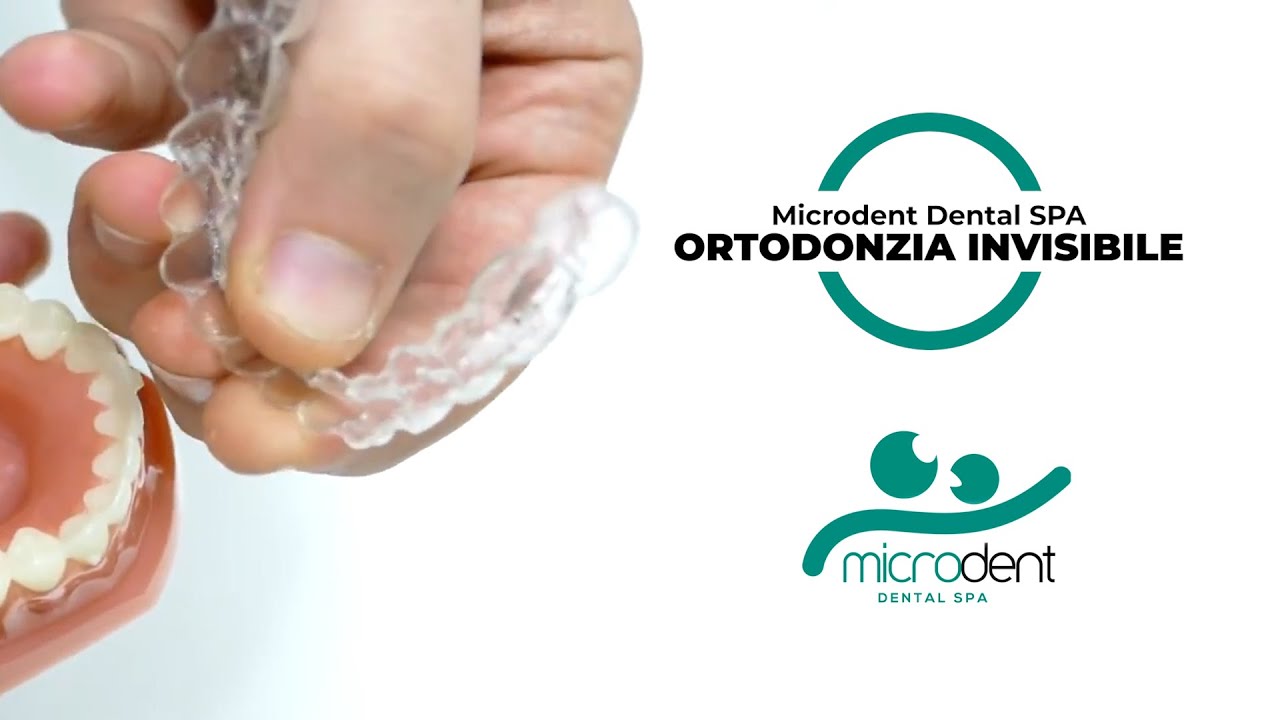 Ortodonzia Invisibile [APPARECCHIO DENTI DRITTI]&nbsp;- Microdent Dental SPA
