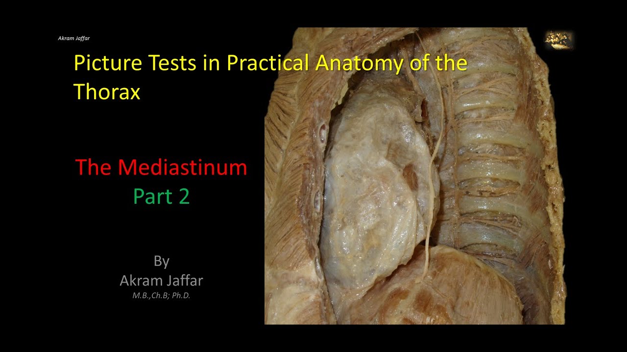 Picture Tests in Anatomy - Thorax - Mediastinum 2 + Anki flachcards