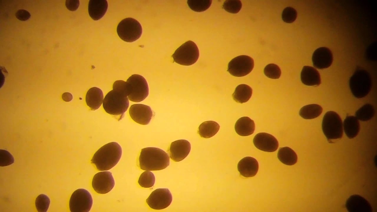 Ciliate parasite (Cryptocaryon irritans) on bream