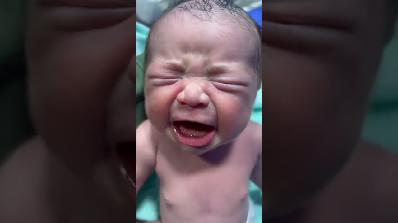 So Cute & Alert! | Complete Newborn Baby Assessment in NICU